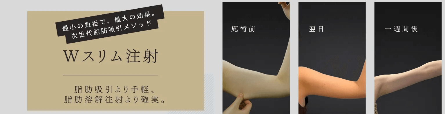 Wスリム注射