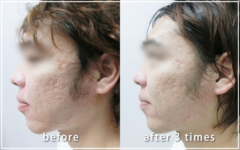 治療経過写真01