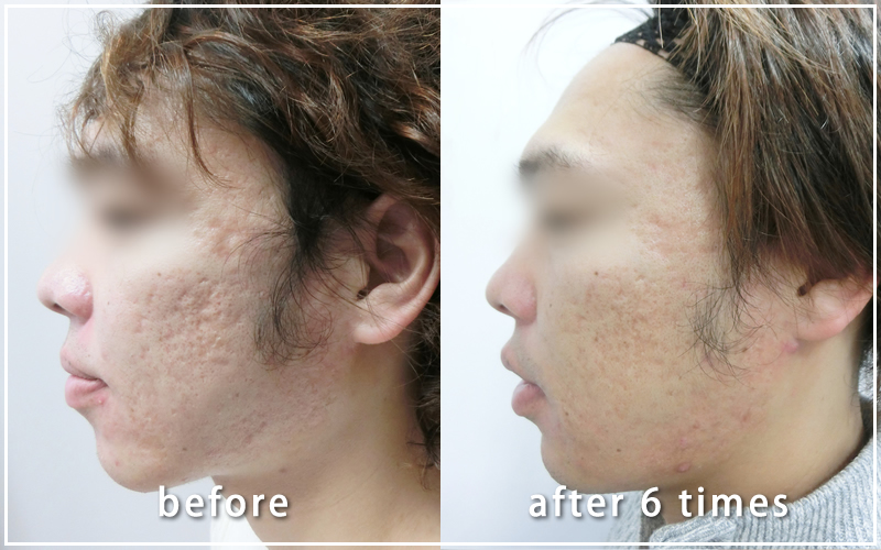 治療経過写真02