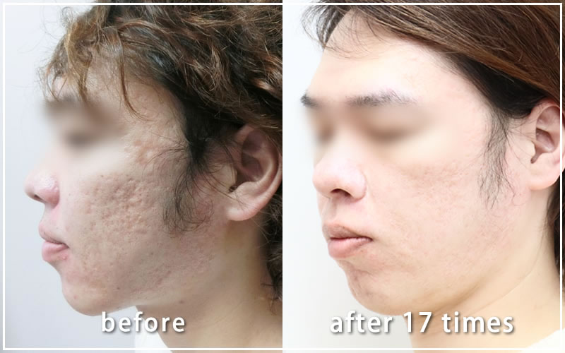 治療経過写真06